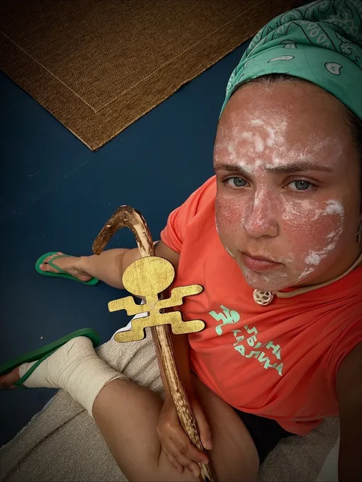 Альбина Кабалина повредила ногу Альбина Кабалина повредила ногу