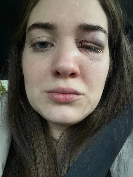 Мария после избиения