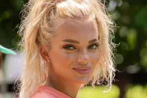 «Из-за стресса поехало лицо и болит челюсть»: Екатерина Шкуро призналась, что страдает после пластики