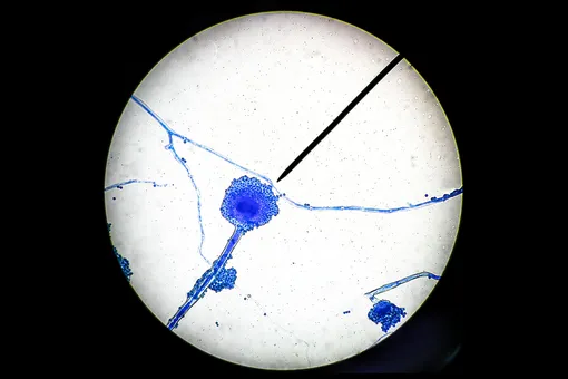 Черный грибок: всё о новом осложнении от коронавируса в Индии