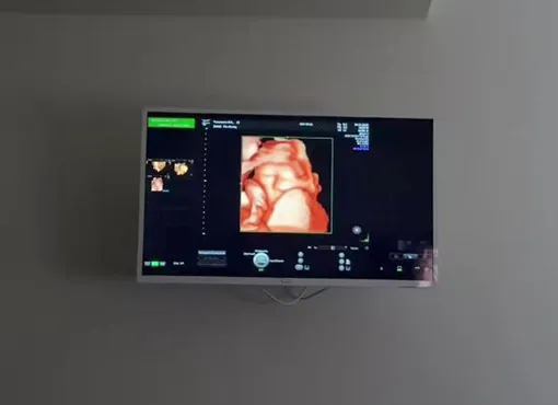 Лерчек побывала на скрининге