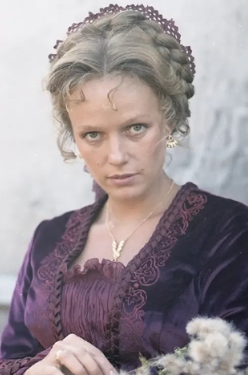 Российские знаменитости после пластики