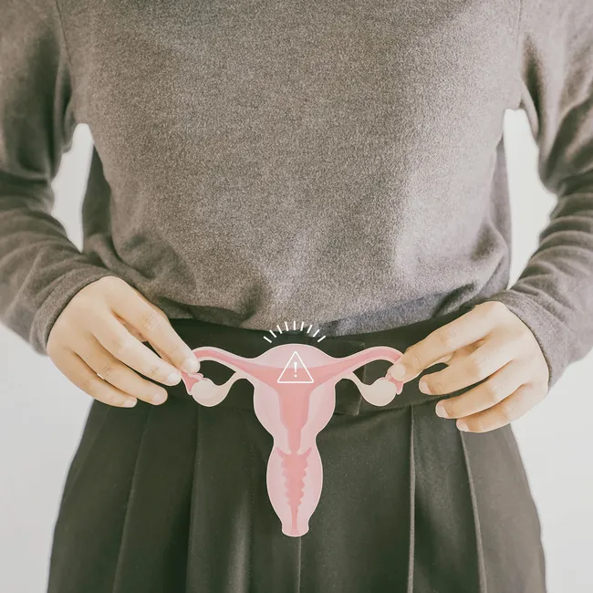 6 ранних признаков рака шейки матки, на которые почти никто не обращает внимания