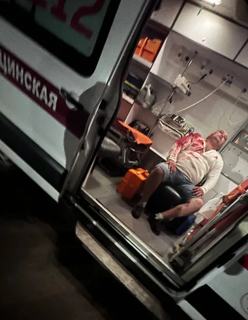 Медведь ранил концертного директора певицы Вадима Фатхинурова