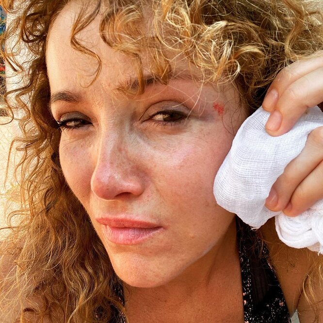 Переломы и сотрясение мозга: звезда «Фабрики звезд-1» едва не погибла в ...