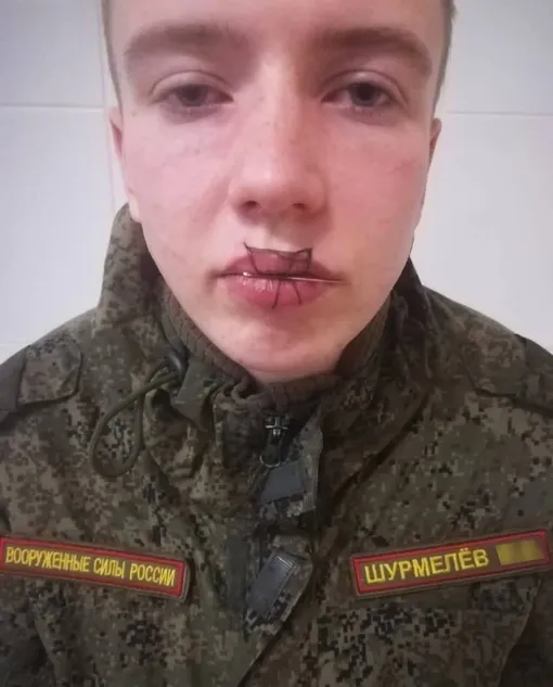 Иван зашил себе рот