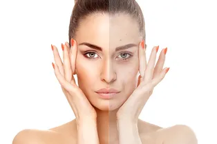 Глютеновое старение: найдена причина появления ранних морщин! Глютеновое старение: найдена причина появления ранних морщин!