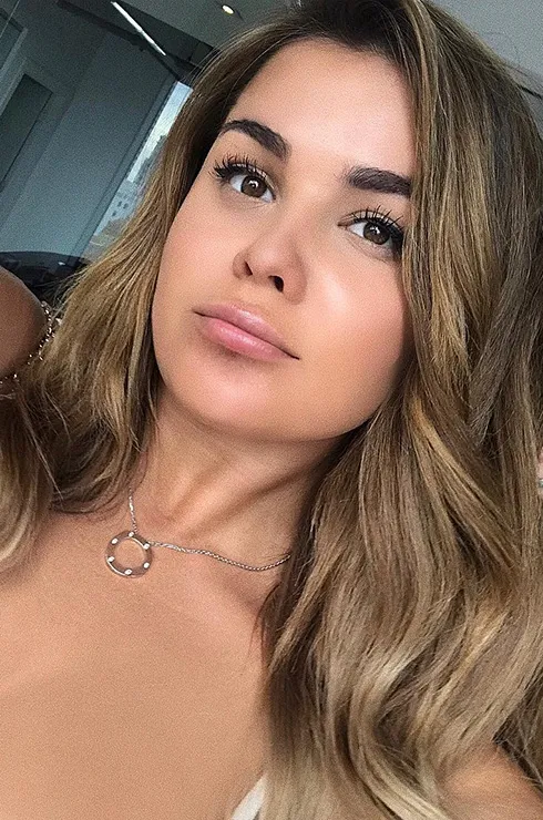 звезды губы до и после