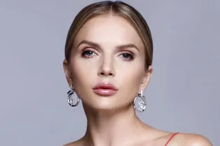 «Что уж скрывать, я сделала ботокс»: Юлия Михальчик рассказала о своем преображении