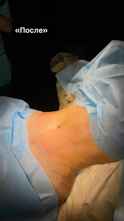 Мама Ирины Пинчук решилась на пластику