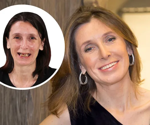 Наталья Гончарова, Красота на Миллион для VOICE Наталья Гончарова, Красота на Миллион для VOICE