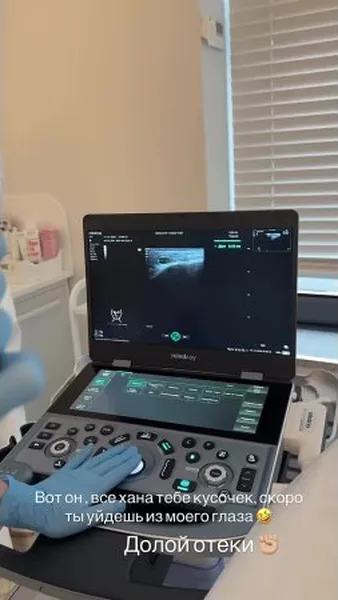 Нажми и смотри