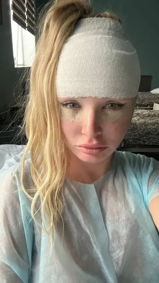 Дарья Пынзарь после пластики