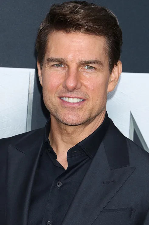 виниры у звезд фото