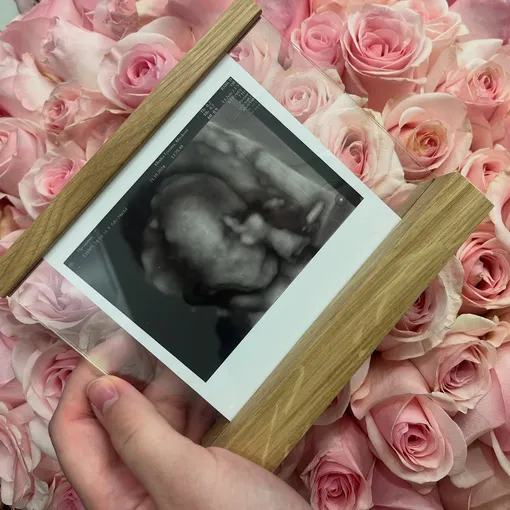 У Ирины Певчей и Александра Сакова родился сын