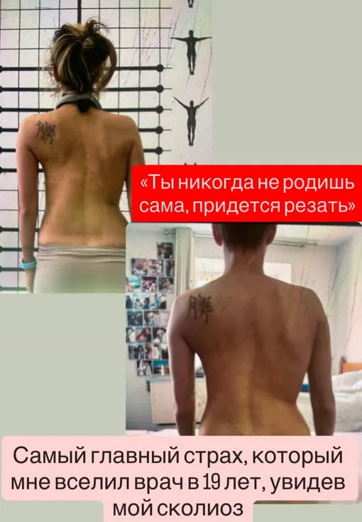 Регина Тодоренко рассказала о своем диагнозе Регина Тодоренко рассказала о своем диагнозе