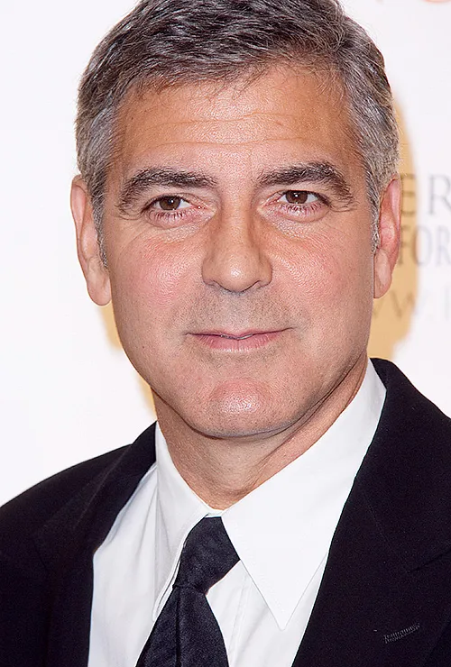 звезды до и после блефаропластики