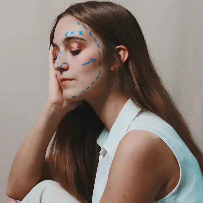 Как меняется нос после ринопластики в течение года: наглядные примеры пациенток