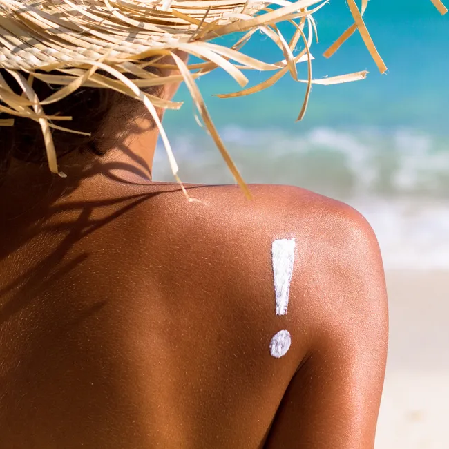 Что делать, если сгорела на солнце, — инструкция от экспертов