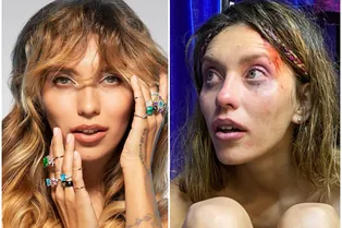 «Жесткая сцена!»: полуголая Регина Тодоренко с разбитой головой шокировала звезд «Жесткая сцена!»: полуголая Регина Тодоренко с разбитой головой шокировала звезд