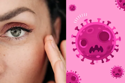 Замерли и портят жизнь: что такое зомби-клетки и как они мешают твоей коже обновляться Замерли и портят жизнь: что такое зомби-клетки и как они мешают твоей коже обновляться