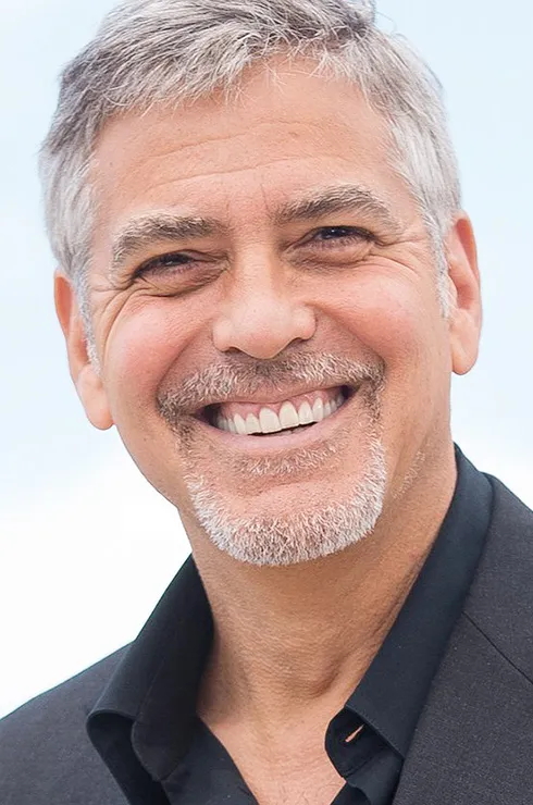 виниры у звезд фото до и после