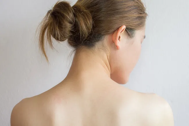 Как навсегда избавиться от прыщей на спине: домашний уход и салонные процедуры