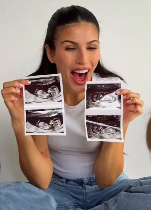 Эмили Миллер ждет двойню