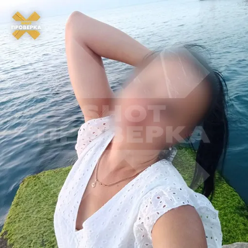 Анна умерла после пластики