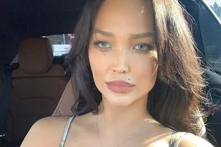 «Рискованно и опасно»: какие пластические операции могла сделать молодая жена Цекало — узнал VOICE «Рискованно и опасно»: какие пластические операции могла сделать молодая жена Цекало — узнал VOICE