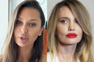 «Глаза перетянуты»: Виктория Боня и Катя Гордон заявили, что Анджелина Джоли сделала пластику лица