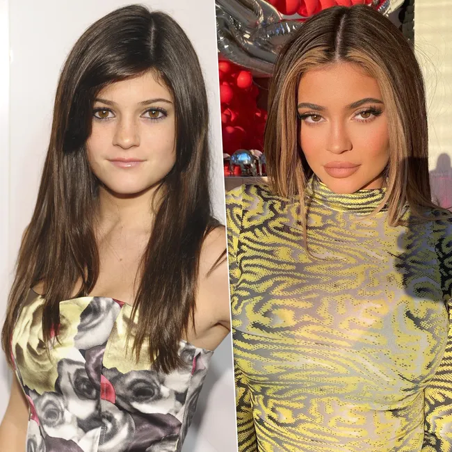 372 миллиона рублей на красоту: самые дорогие звездные «преображения» у хирургов