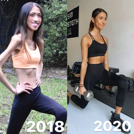 Жительница Мельбурна довела себя до истощения