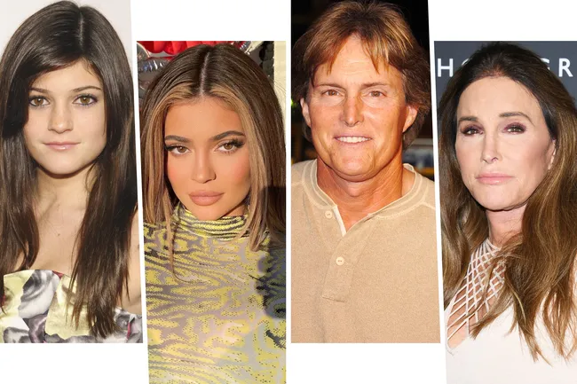 372 миллиона рублей на красоту: самые дорогие звездные «преображения» у хирургов