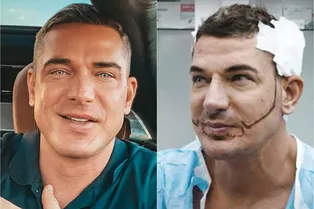 «Это ад!»: бывшему мужу Ксении Бородиной пересадили волосы с головы на лицо «Это ад!»: бывшему мужу Ксении Бородиной пересадили волосы с головы на лицо