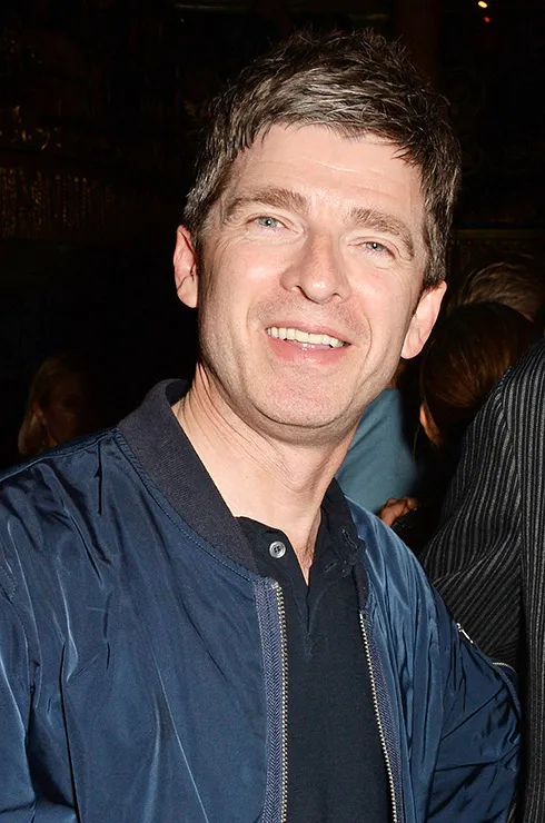 виниры у звезд фото до и после