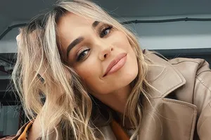 «Я решилась на пластическую операцию»: Анна Хилькевич призналась, что «нюанс» мешает ей в жизни