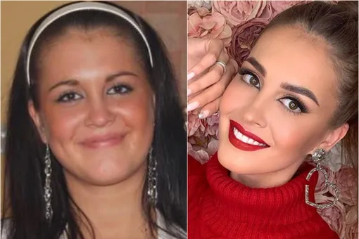 «Я похудела на 15 кг»: сестра Ольги Бузовой показала фото до и после сброса веса «Я похудела на 15 кг»: сестра Ольги Бузовой показала фото до и после сброса веса
