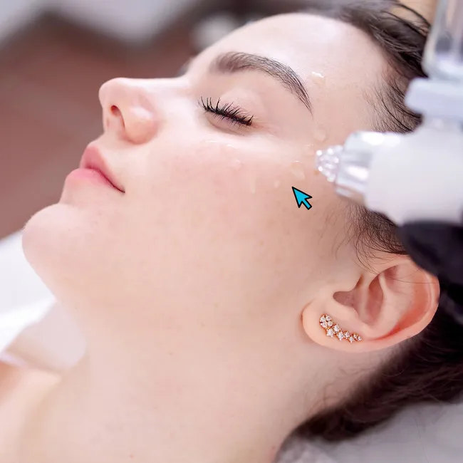 Тренды липосакции лица. Почему операция буквально захватывает «рынок»?