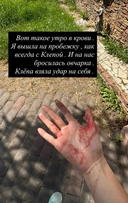 Питомец Иланы Дылдиной пострадал от соседской овчарки Питомец Иланы Дылдиной пострадал от соседской овчарки
