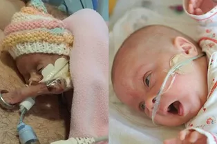 Родители показали крохотную дочку, родившуюся на 27-й неделе Родители показали крохотную дочку, родившуюся на 27-й неделе