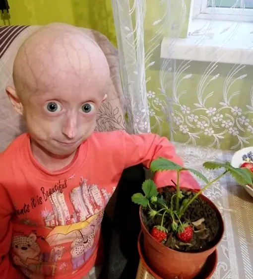 10-летняя девочка умерла от старости