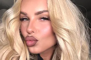 «Я выжигала лазером, это больно»: Ханна призналась, как избавилась от синяков на ягодицах из-за инъекций