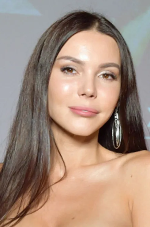 звезды губы до и после