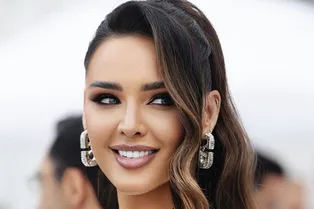 «Мне убрали болты из головы!»: жена Тимура Хайдарова показала рубцы после пластики лица «Мне убрали болты из головы!»: жена Тимура Хайдарова показала рубцы после пластики лица