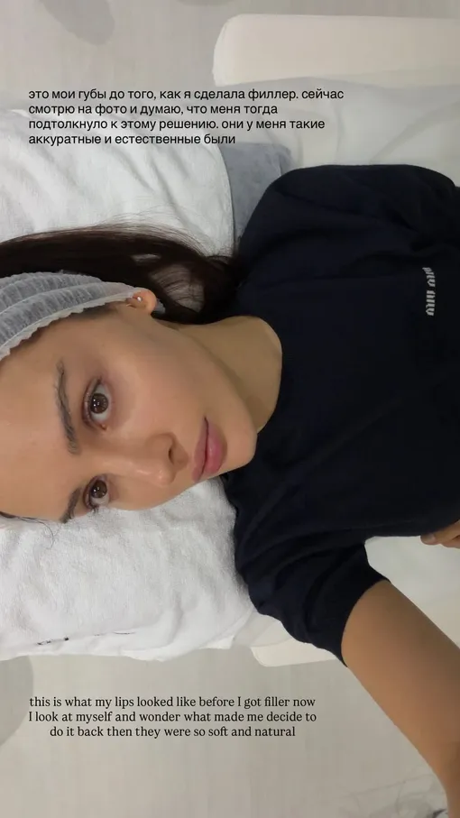 Артистка призналась, что зря увеличила губы