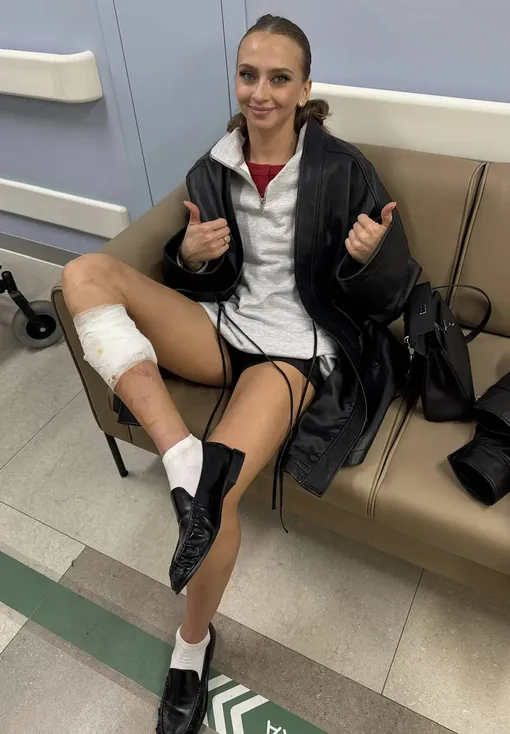 Виктории Синицыной наложили два шва на ногу