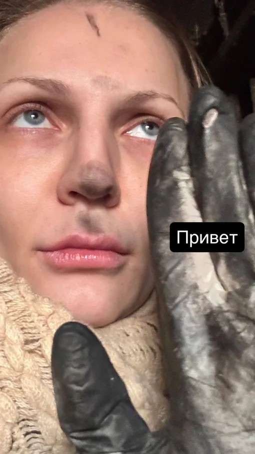 Екатерина Лукаш во время пожара успела выбежать на улицу