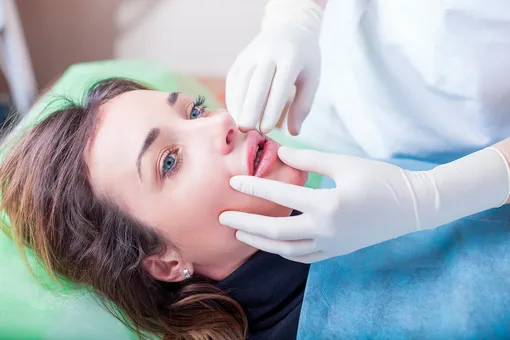 Что такое lip lift и почему его выбирают женщины с «усталыми» губами, а не те, кто хочет пухлости
