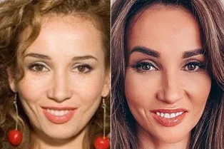 «Я себя перекроила?»: Анфиса Чехова показала изменения во внешности за 13 лет